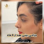 دکتر محمودی بهترین پزشک عمل بینی اصفهان