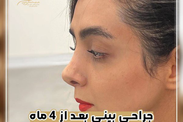 دکتر محمودی بهترین پزشک عمل بینی اصفهان